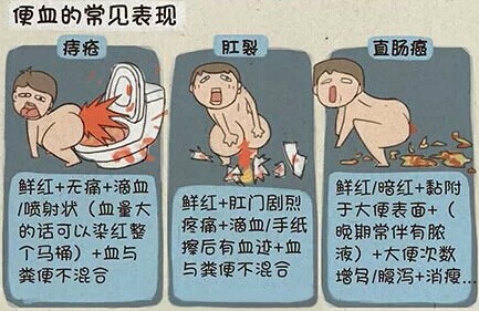 大便出血的原因？